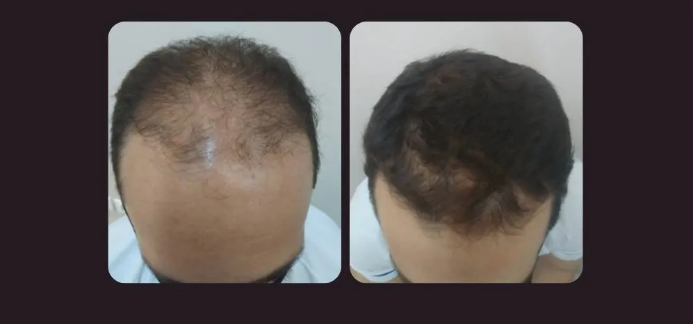 Clínica Eleve-Se Lança Campanha do Dia dos Pais Focada em Autocuidado Masculino e Ofertas Especiais